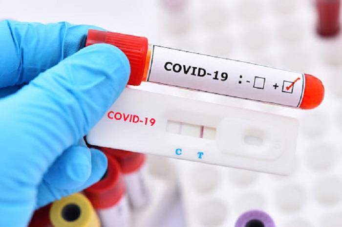 Bộ Y tế đề nghị báo cáo giá bán test xét nghiệm SARS-CoV-2