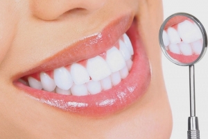 Những nguy cơ thường gặp từ việc tẩy trắng răng